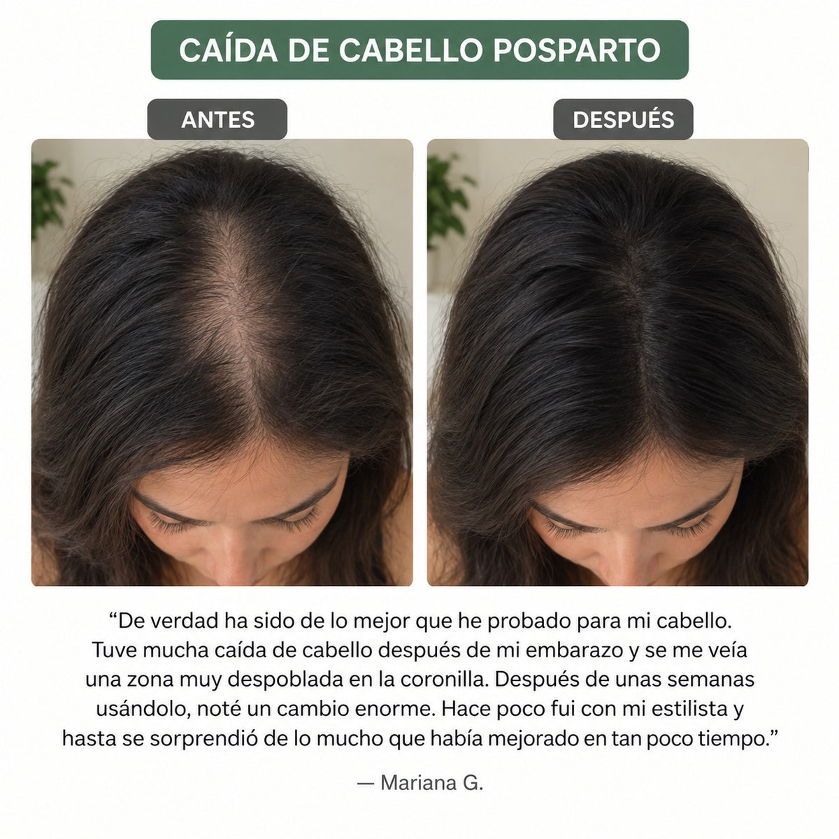El kit definitivo para el crecimiento del cabello