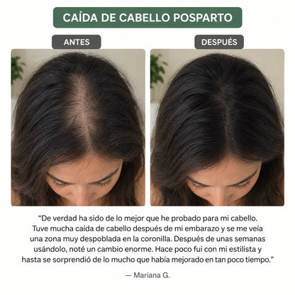 El kit definitivo para el crecimiento del cabello