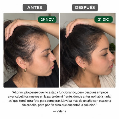 El kit definitivo para el crecimiento del cabello