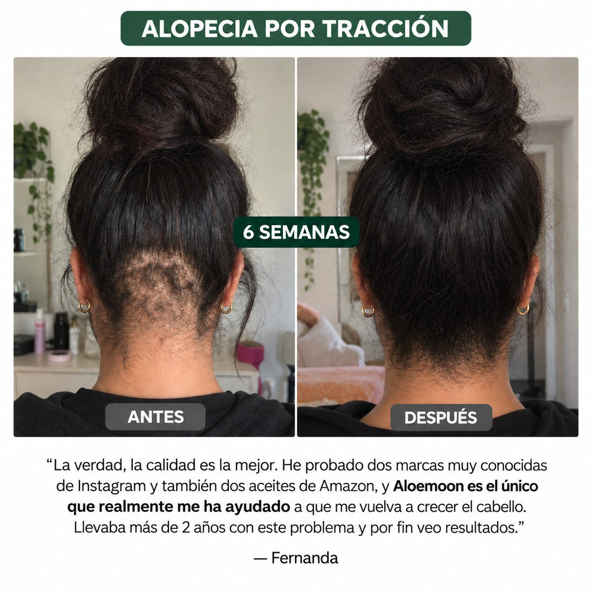 El kit definitivo para el crecimiento del cabello