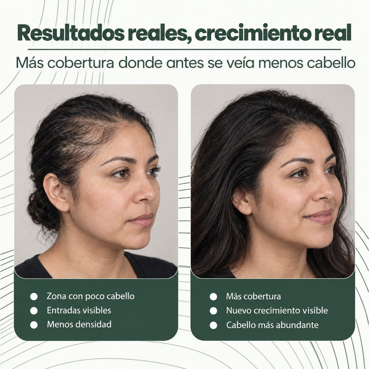 Recupera Tu Cabello — Aceite de Batana 100% Puro